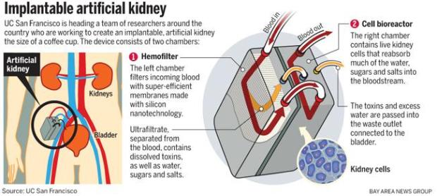 How does the bioartificial kidney work How does the bioartificial kidney work