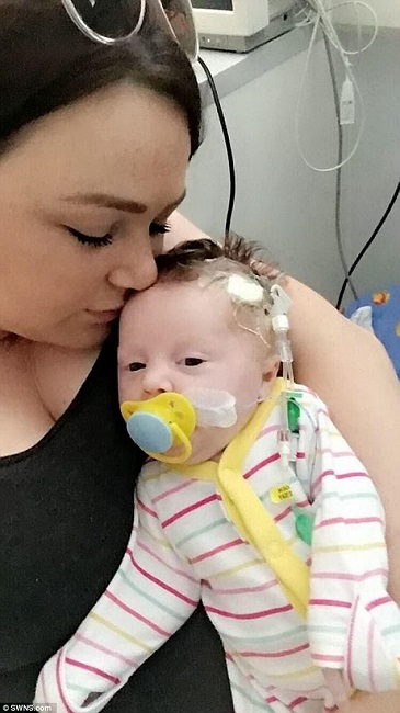 baby born with organ outside baby born with organ outside body