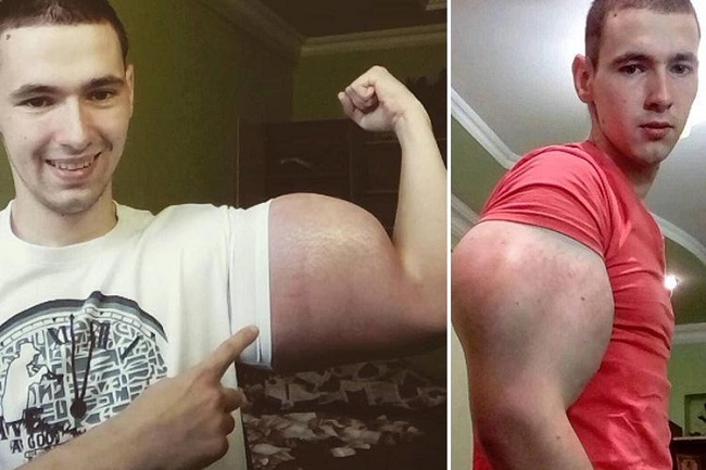 But he insists on continuing But he insists on continuing