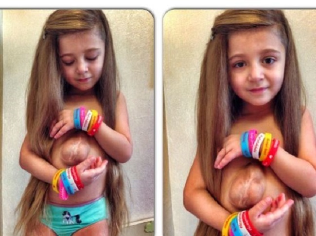 girl with heart outside her body girl with heart outside her body