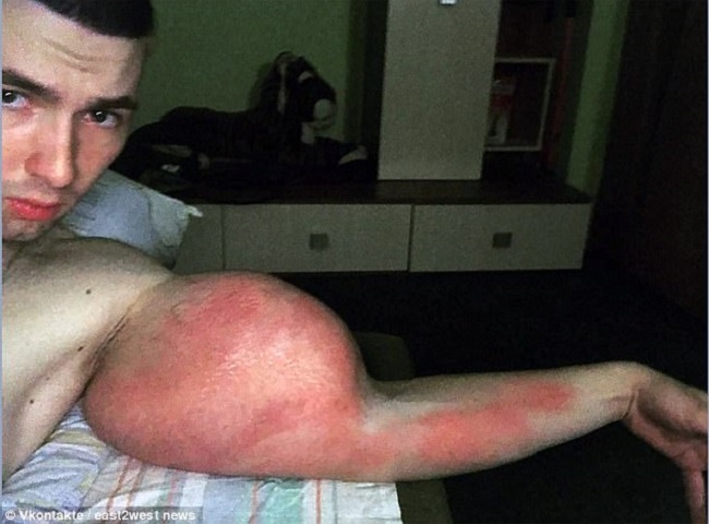 The condition of his arms are severe warn doctors The condition of his arms are severe warn doctors