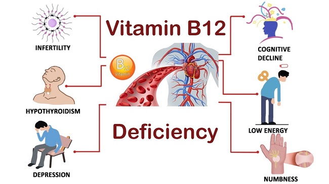 There are many factors causing a vitamin B-12 deficiency