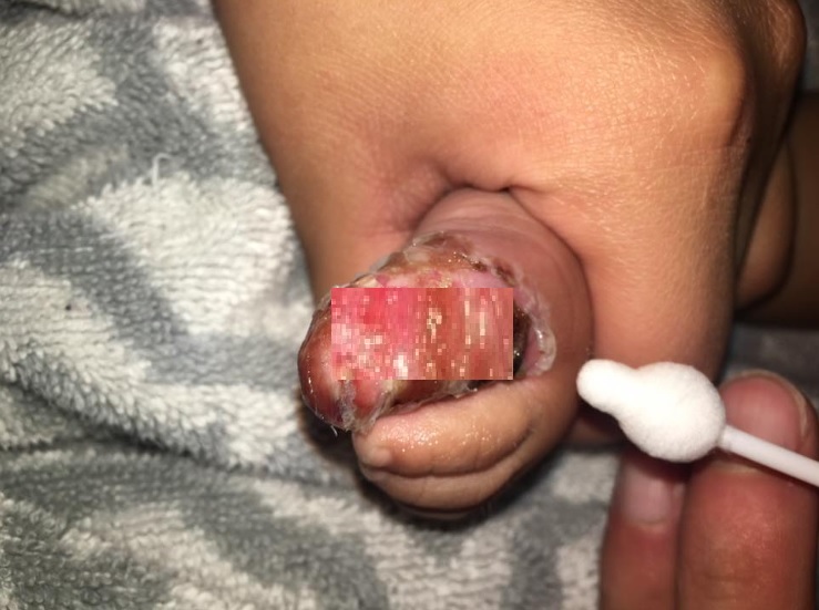 virus kissed Ostiano virus kissed Ostiano