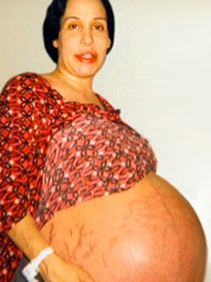 Nadya the octomom Nadya the octomom