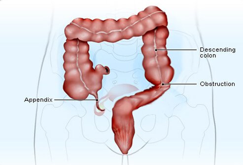 Appendix Appendix