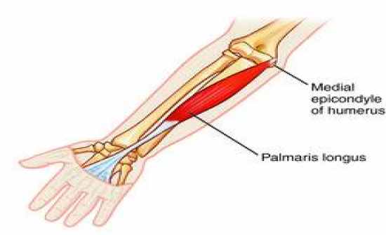 Palmaris muscle Palmaris muscle