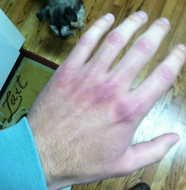 Purple Knuckles Purple Knuckles