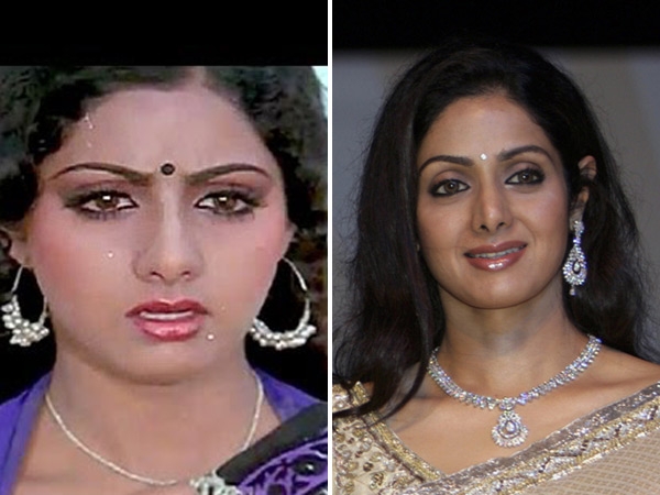 Sridevi after surgery