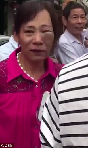 woman’s face badly bruised woman’s face badly bruised