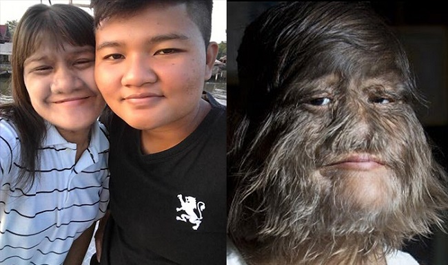 A problem which she manages very well A problem which she manages very well