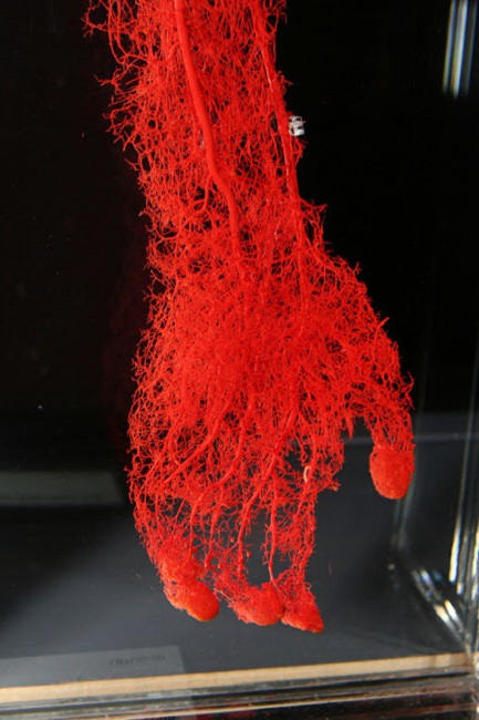 How your hand looks as a network of blood vessels and veins