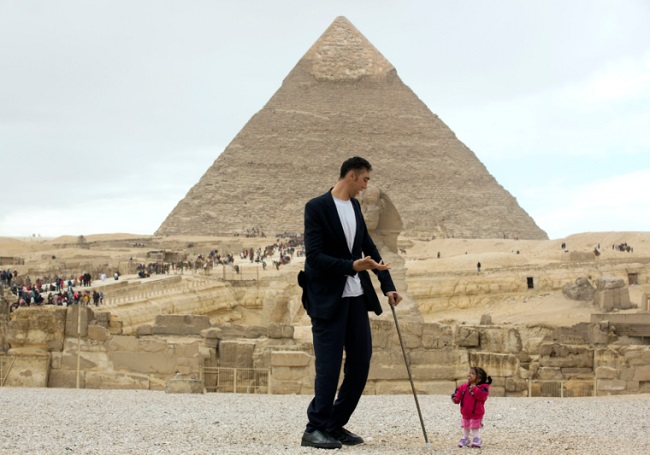 Jyoti is suffering from a form of dwarfism called achondroplasia