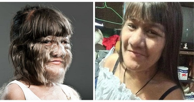 Once named the hairiest girl in the world. Once named the hairiest girl in the world.