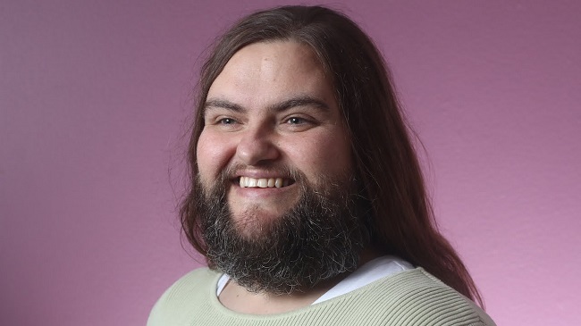 Polycystic ovary syndrome Polycystic ovary syndrome