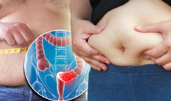 Swollen stomach or enlarged abdomen