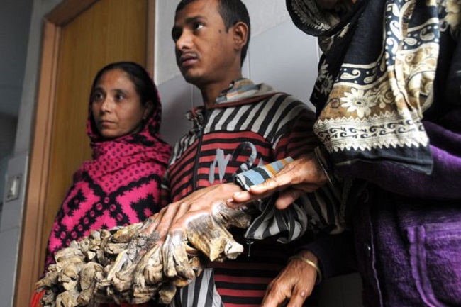 Bajandar’s wife said she is grateful for the free treatment Bajandar’s wife said she is grateful for the free treatment