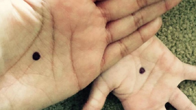 Call cops immediately when you see women with black dot on palm