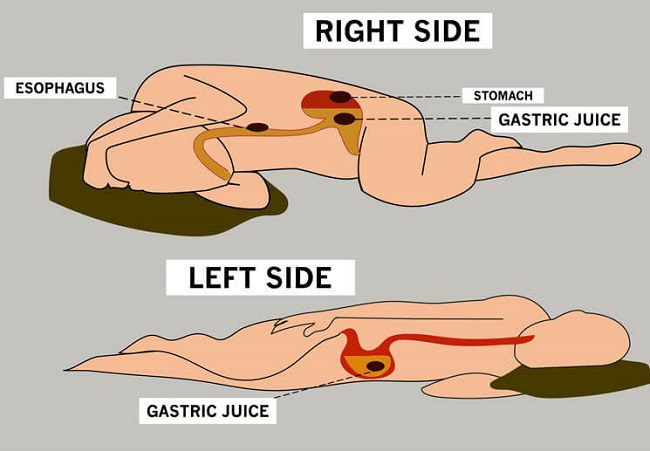 How sleep position affects digestion How sleep position affects digestion