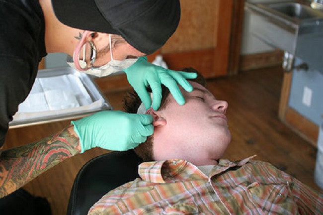 Jewelry size needs to be determined according to cartilage thickness