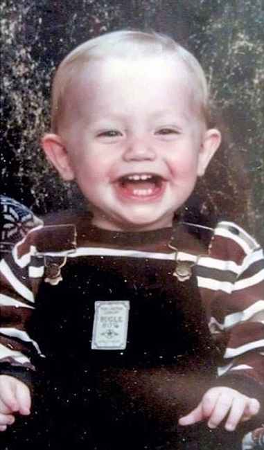 Kyleigh turned to dermal fillers in attempts to make everything better