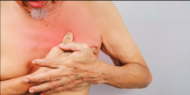 Pain in the nipple or chest region