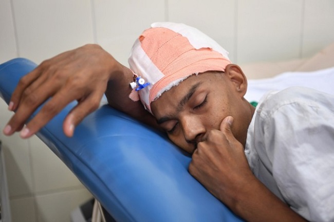 patient after brain tumor removal patient after brain tumor removal