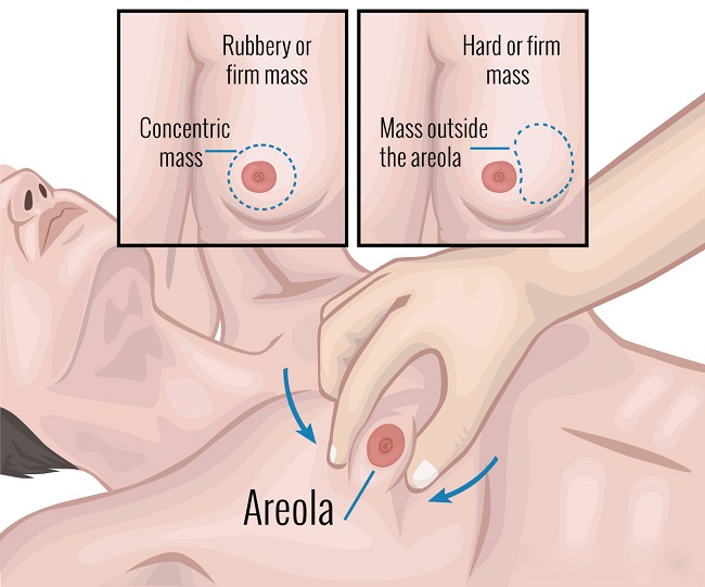 Reduce fat intake Reduce fat intake