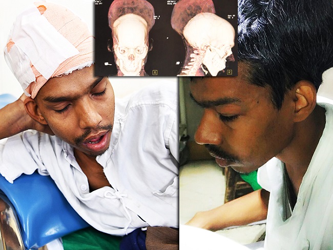 Santlal pal after brain tumor surgery Santlal pal after brain tumor surgery