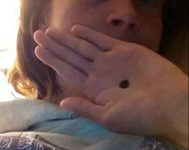 The black dot campaign was started with a Facebook post The black dot campaign was started with a Facebook post