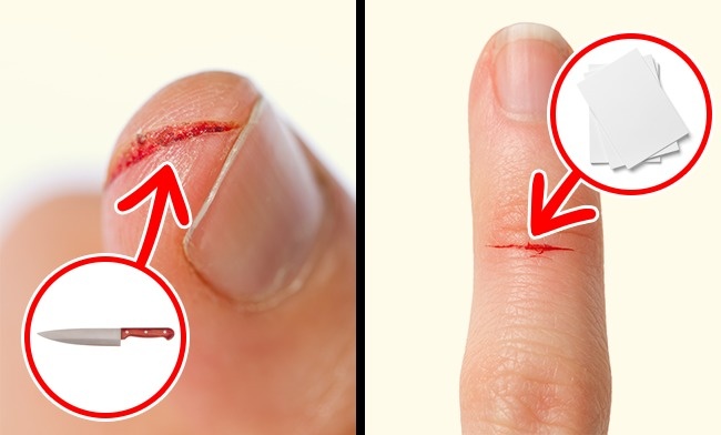 Why a paper cut is more painful than a regular cut