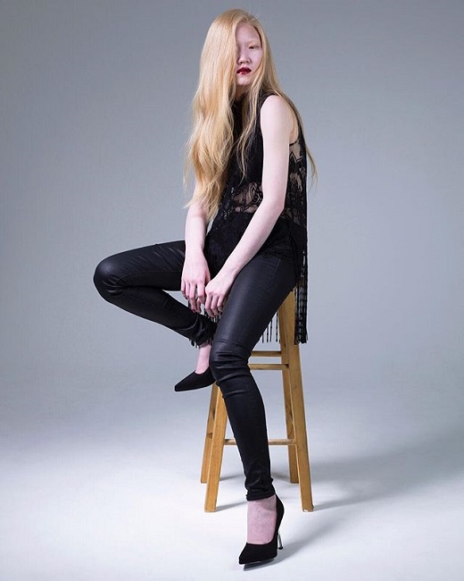 albino model Chihiro albino model Chihiro