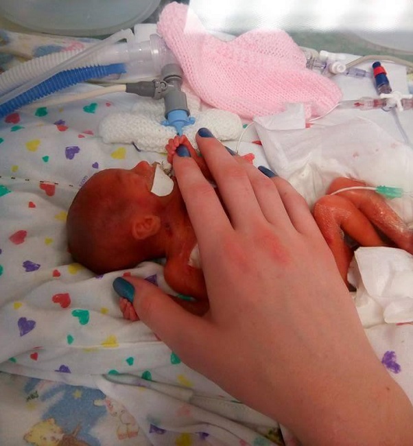 Contractions too early Contractions too early