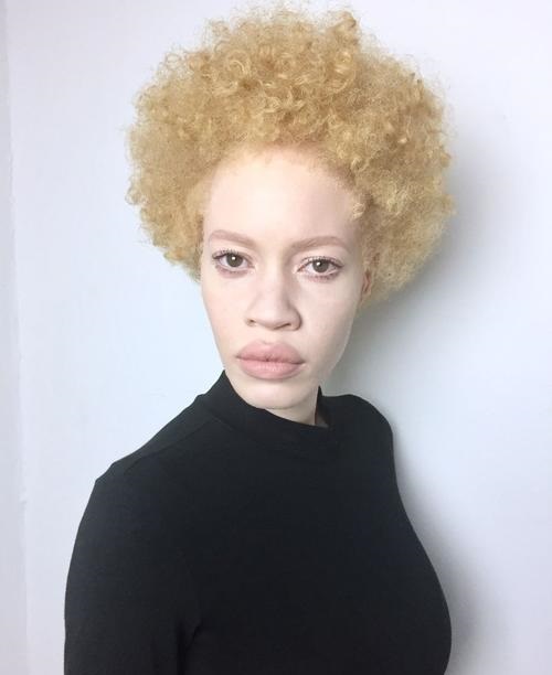 Diandre Forrest first Albino African American model Diandre Forrest first Albino African American model