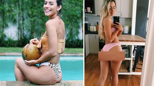 fitness model with butt dimples