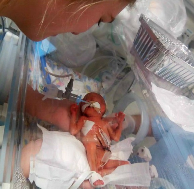 Miracle baby1 Miracle baby