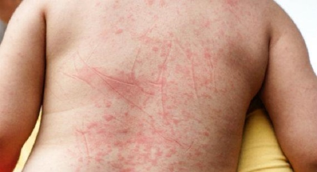 Risk factors Risk factors