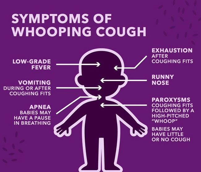 Whooping cough is very infectious