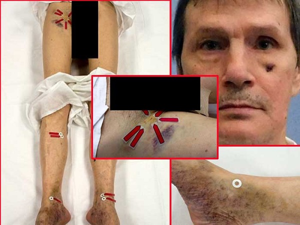 botched and bloody execution botched and bloody execution