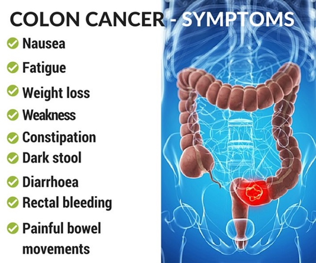 colon cancer symptoms colon cancer symptoms