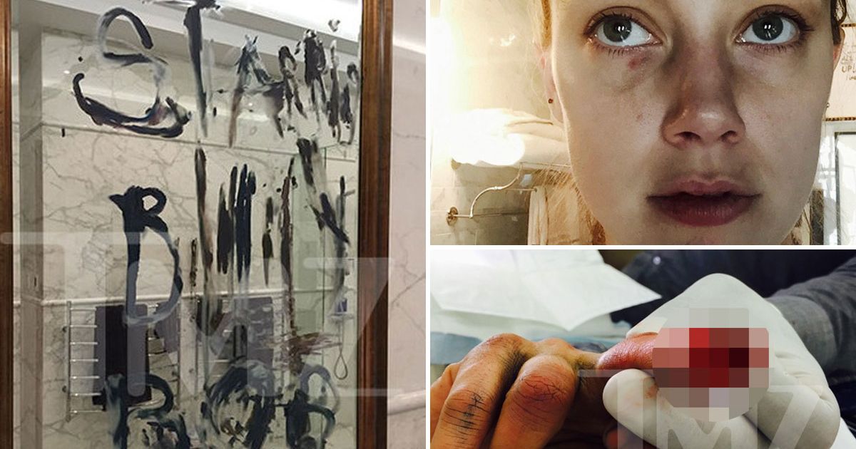 The most bizarre thing in the Johnny-Amber debacle was the pictures