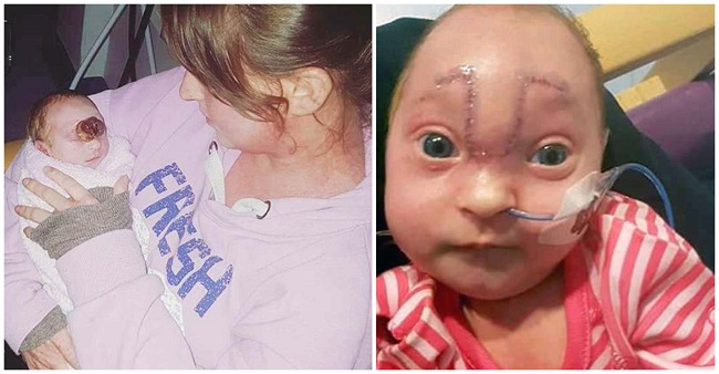 Baby Karlie after operation Baby Karlie after operation