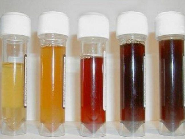 Changes in the Color of Urine