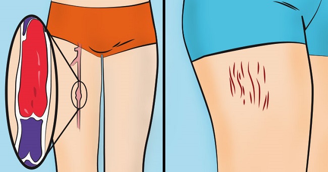 Discolouration in parts of your body Discolouration in parts of your body