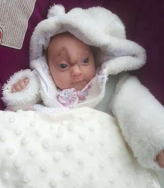 Karlie the miracle baby Karlie the miracle baby