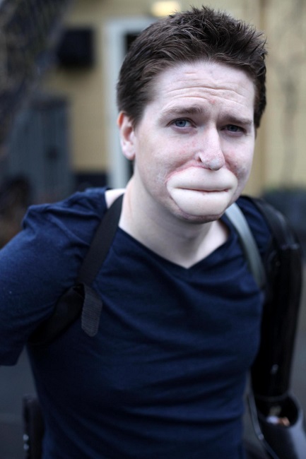 man with flu man with flu