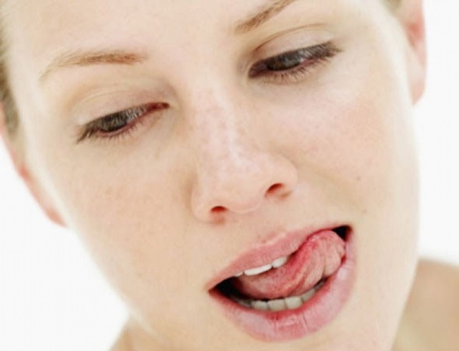 Phobia of dry lips Phobia of dry lips