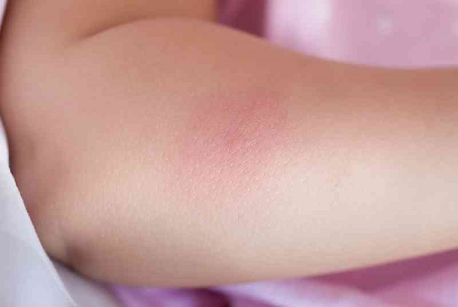 Swelling should always be checked Swelling should always be checked