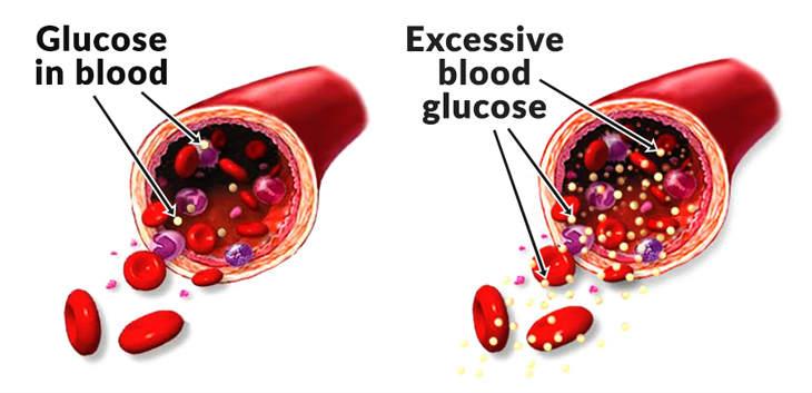 Blood sugar is the last to increase in the body