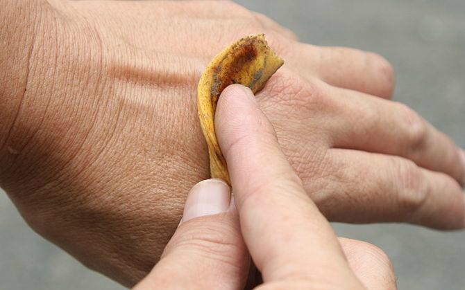 Getting rid of warts Getting rid of warts