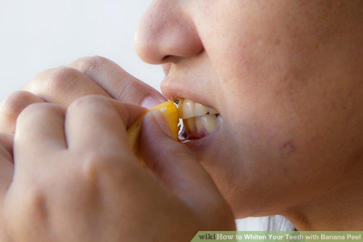 Whiten your teeth Whiten your teeth